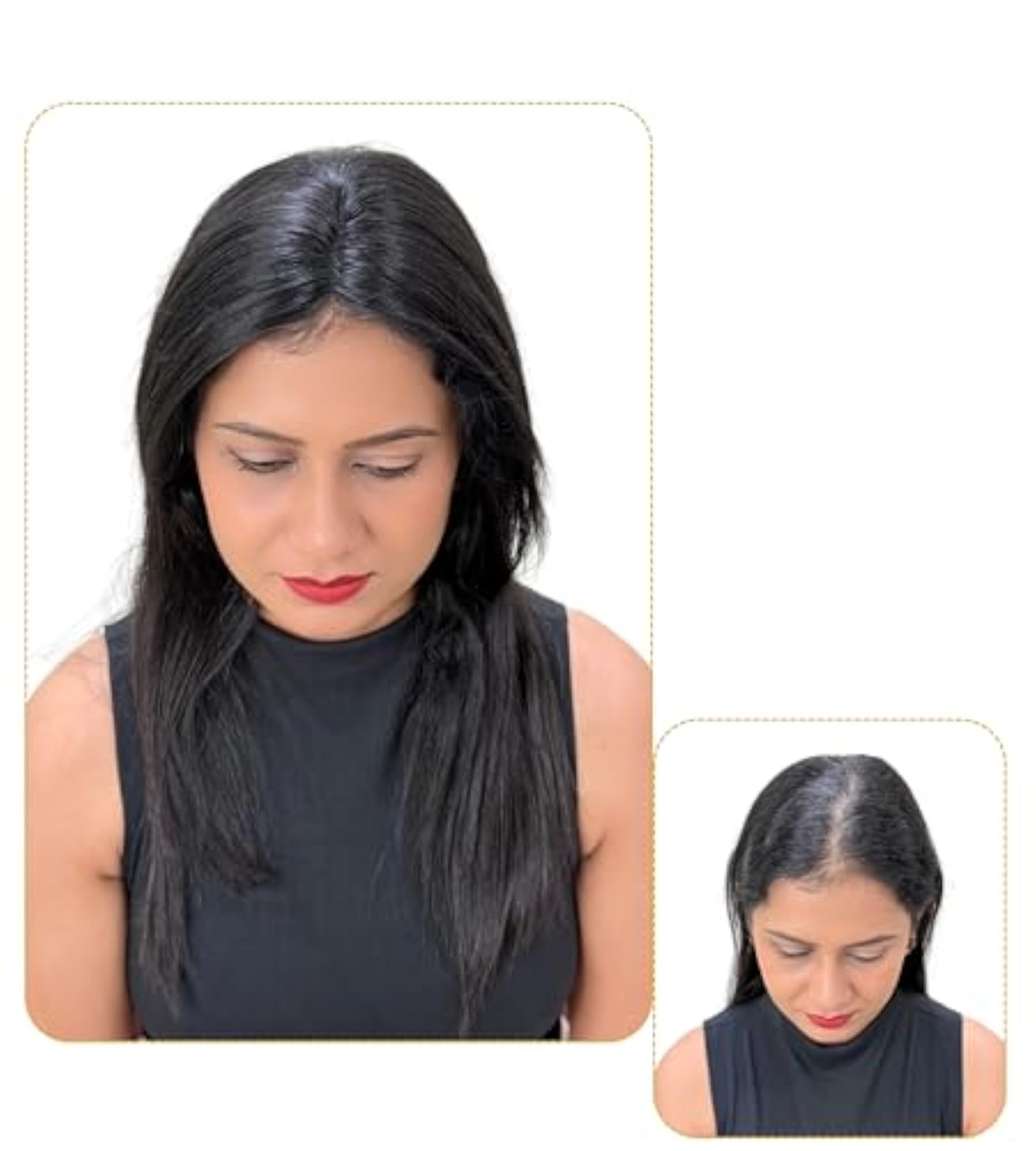 Lace Topper for Women, Thinning Hair Coverage